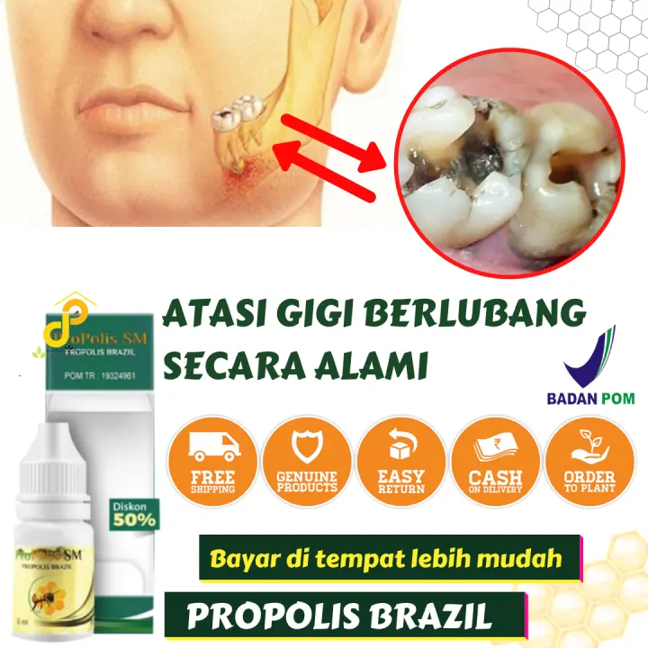 Obat Cara Untuk Menghilangkan Gigi Berlubang Obat Propolis Sakit Gigi Obat Membersihkan Karang Gigi Obat Sakit