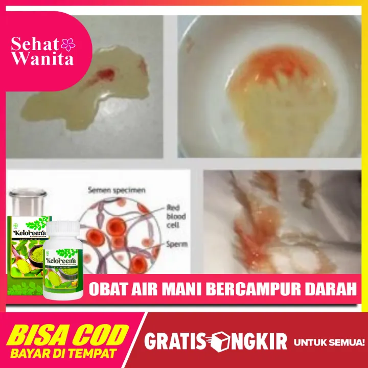 Obat Herbal Air Mani Bercampur Darah Air Mani Warna Coklat Penambah Penyubur Sperma Keloreena Lazada Indonesia
