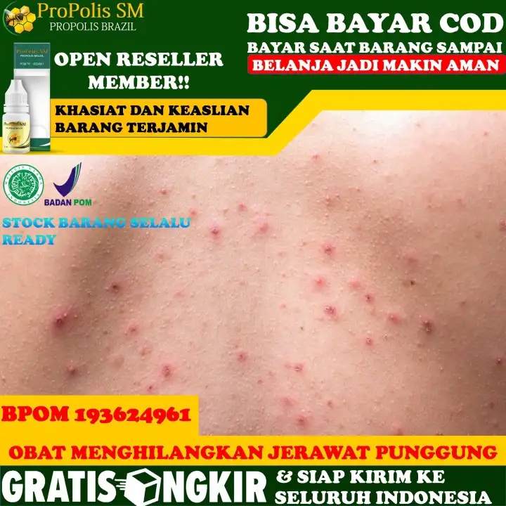 Penyakit Mematikan Ternyata Bisa Dilihat Dari Kulit Kenali 7 Tandanya Halaman All Tribunjabar Id