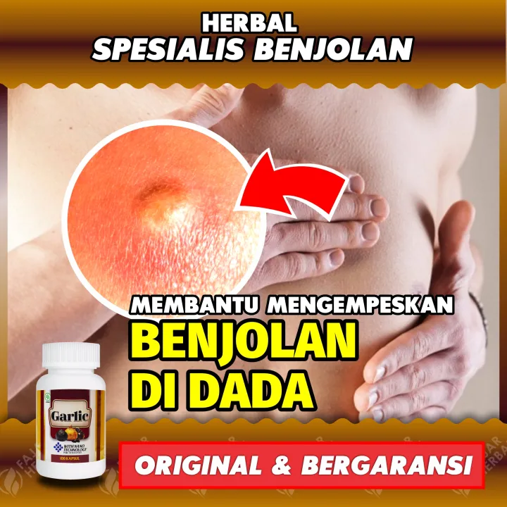 Obat Menghilangkan Benjolan Di Dada Di Sebelah Kiri Dada Sebela Kanan Dada Atas Dada Tengah Pria Wanita Laki Laki Perempuan Benjolan Di Dada Tengah Seperti Jerawat Benjolan Di Tubuh Lazada Indonesia