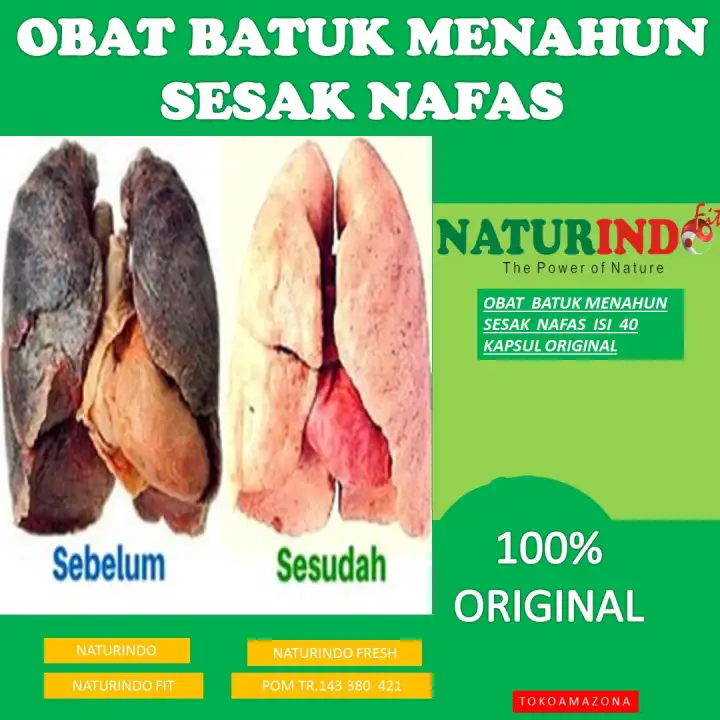 Obat Batuk Menahun Sesak Nafas Tak Kunjung Sembuh 100 Herbal Alami Naturindo Lazada Indonesia