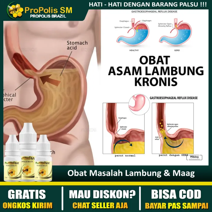 Sesak Nafas Karena Lambung Bengkak