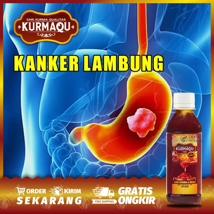 Madu Alami Obat Herbal Asam Lambung Maag Akut Asam Lambung Gerd Tukak Lambung Kanker Lambung Maag