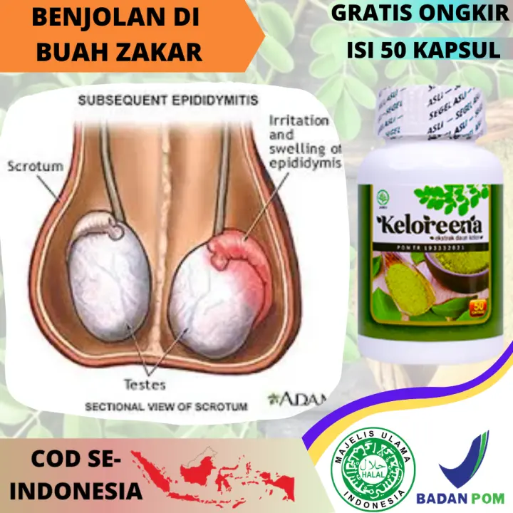 Obat Benjolan Di Buah Zakar Herbal Penghilang Benjolan Keras Buah Zakar Pengecil Benjolan Pada Kantung Testis