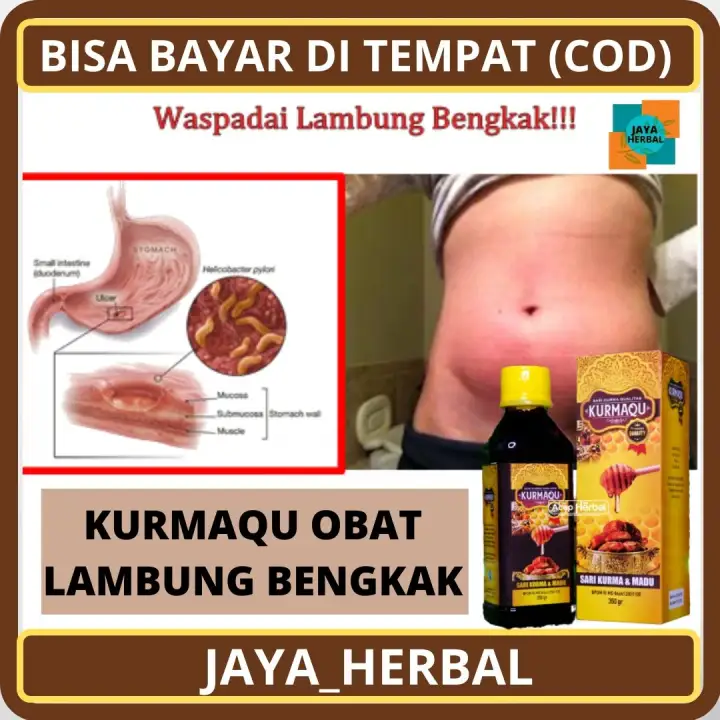 Obat Lambung Bengkak Herbal Termurah Obat Asam Lambung Naik Herbal Lambung Perih Obat Alami Lambung Bocor