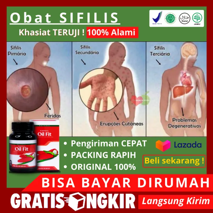 Obat Sipilis Pria Obat Kencing Nanah Gonore Obat Sifilis Alami 100 Sifilis Spilis Raja Singa Obat Untuk Penyakit Sipilis Penghilang Luka Sipilis Dgn Oil Fit Kapsul 100 Asli Ll Bisa Berkhasiat Lazada Indonesia