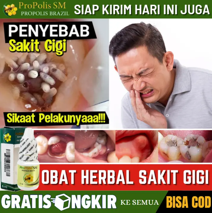 Obat Sakit Gigi Alami Untuk Usia 2 Tahun Ke Atas Obat Sakit Gigi Bolong Sakit Gigi