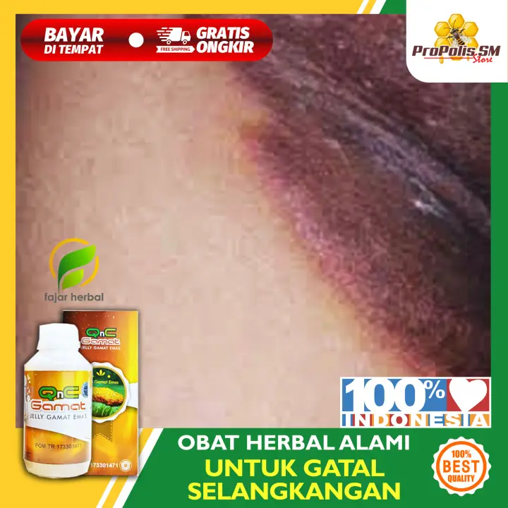 Obat Selangkangan Hitam Dan Mengelupas Obat Pencerah Pemutih Selangkangan Obat Selangkangan Hitam Dan Lecet Obat Selangkangan