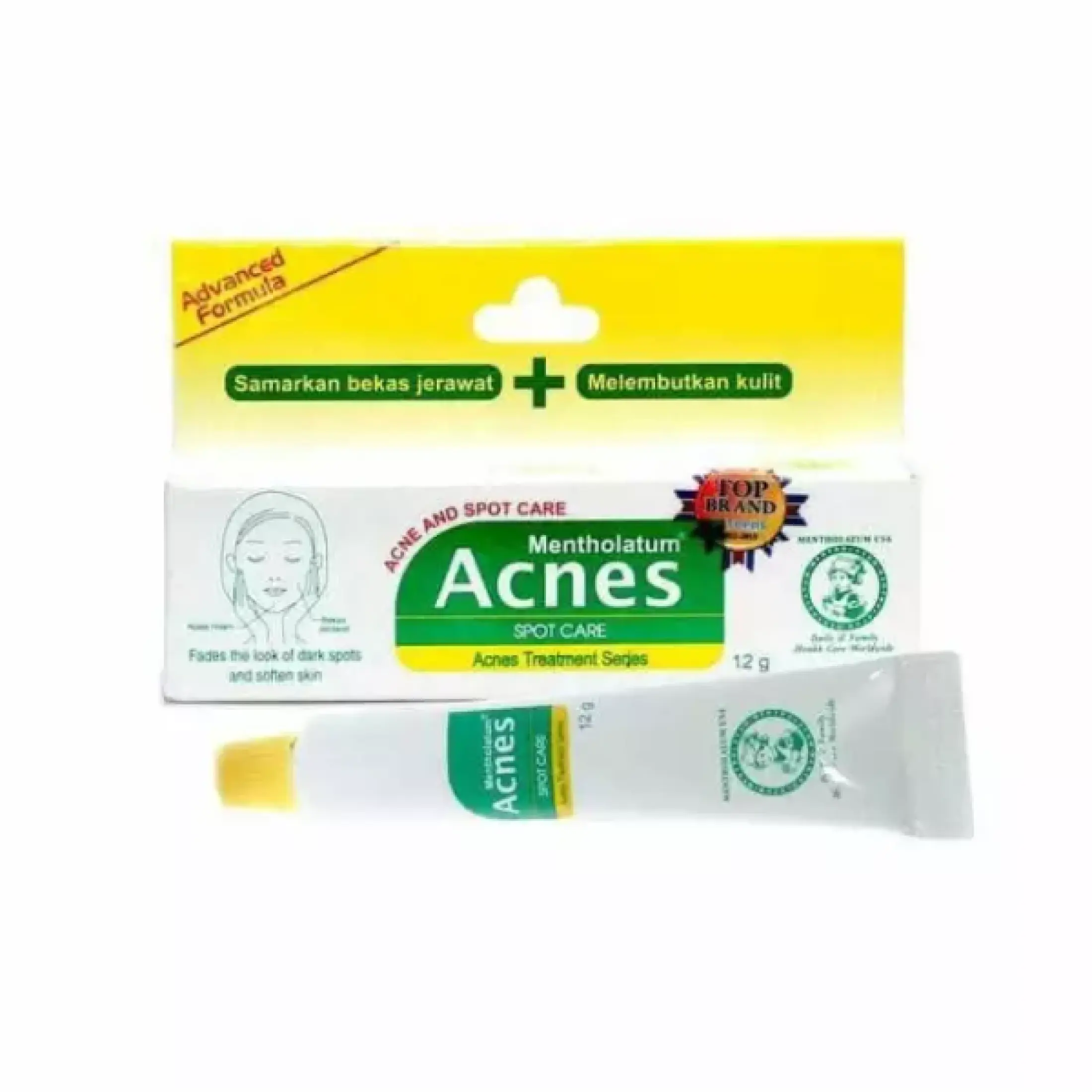 Penghilang Bekas Jerwat Acnes Spot Care 12g Acne Gel Penghilang Bekas Jerawat Acne Treatment Acne Care Melembabkan Kulit Mengangkat Sel Kulit Mati Merawat Bekas Jerawat Obat Jerawat Ampuh