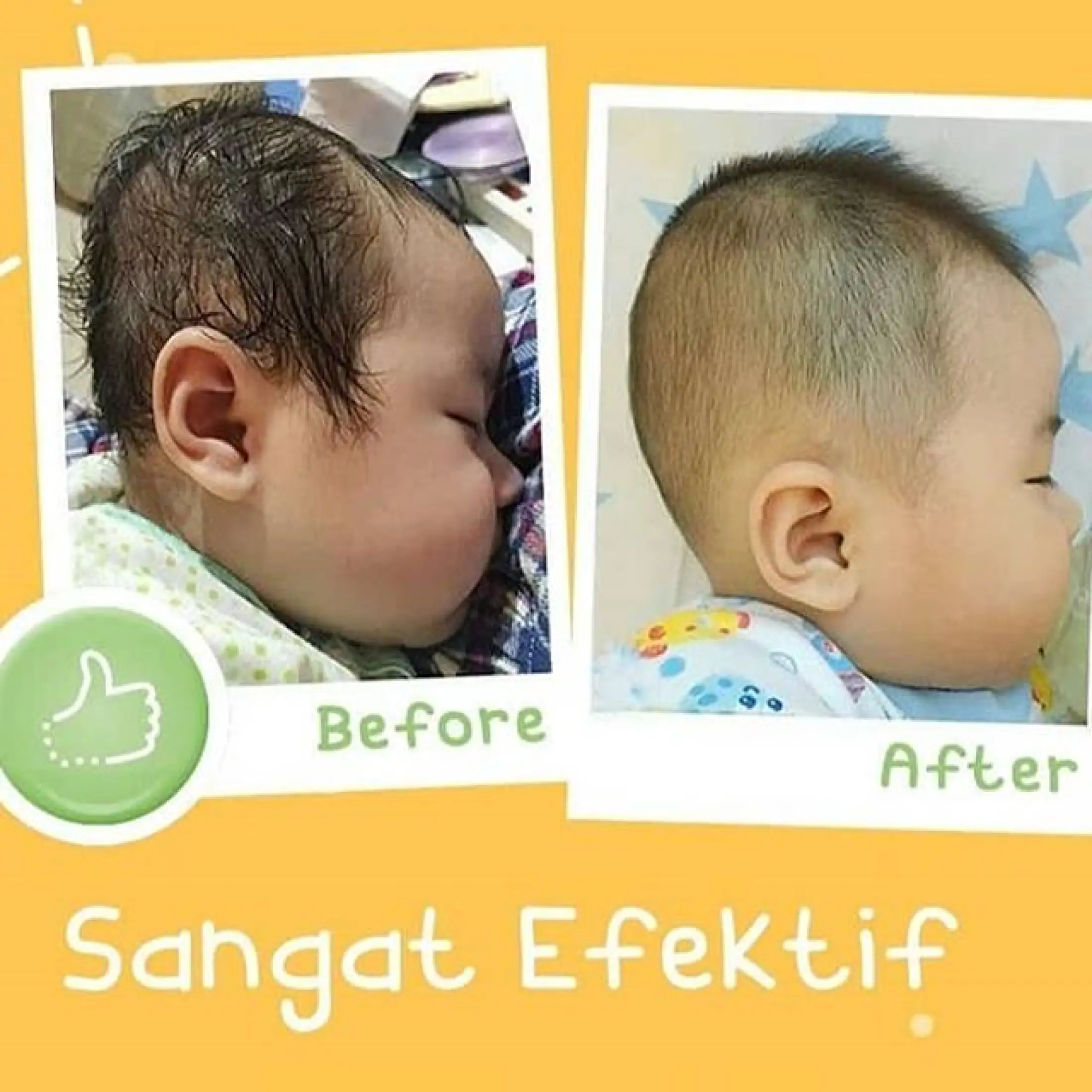 Olus Pillow Bantal Kesehatan Bayi Anti Peyang Terlaris Bantal Anti Peang Bantal Terapi Agar Kepala Bayi Bulat Sempurna Dan Tidak Peyang Olus Pilow Bantal Peang Bantal Bayi Murah Bantal Kesehatan Olus Pillow Set Olus Pillow<script async src=