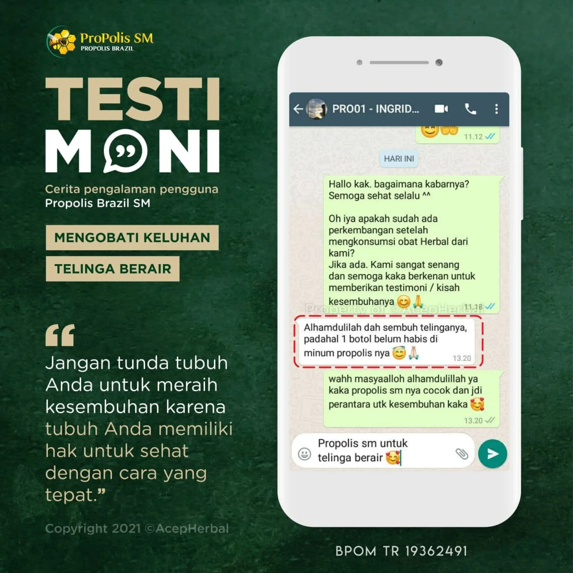 Obat Tetes Telinga Berair Dan Bau Curek Telinga Bernanah Pelunak Kotoran Keras Congek Telinga Tersumbat Telinga Berdengung Terus Menerus Telinga Tidak Bisa Mendengar Propolis Sm Brazil 100 Asli Bpom Lazada Indonesia