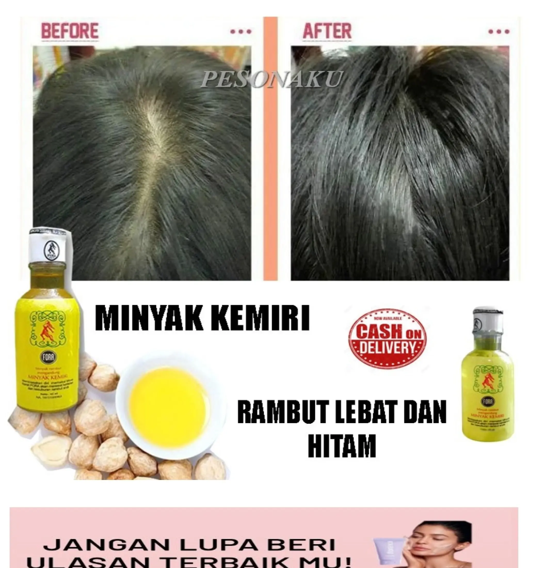 Minyak Kemiri Fora Penghitam Rambut Pelebat Rambut Menghitamkan Rambut Ampuh Melebatkan Rambut Permanen Melembutkan Rambut Menutri Rambut Rusak Rontok Minyak Kemiri Penghitam Rambut Bpom Original Ampuh Aman Untuk Busui Bumil Bayar Ditempat Cod