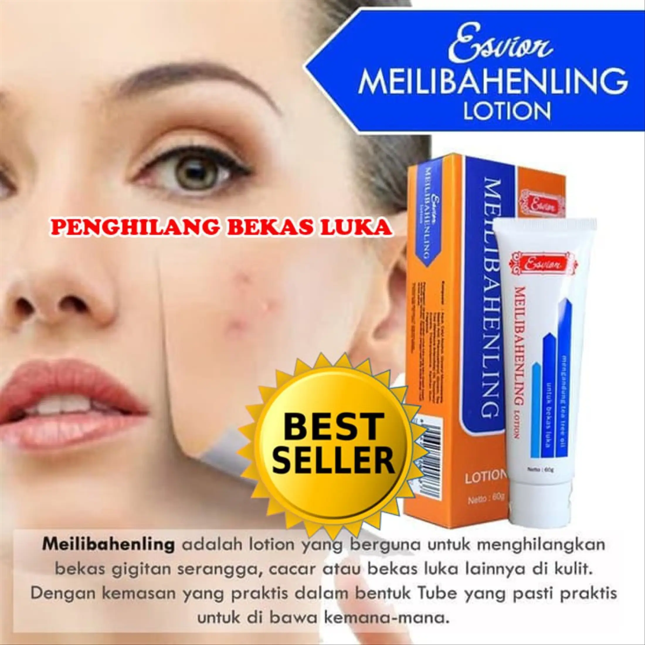 Cream Penghilang Bekas Luka Meilibahenling Aman Dijamin 100 Original Bpom Obat Penghilang Bekas Luka Lama Cream Penghilang Luka Cream Pemutih Kulit Tubuh Penghilang Bekas Luka Koreng Obat Penghilang Bekas Luka Bakar