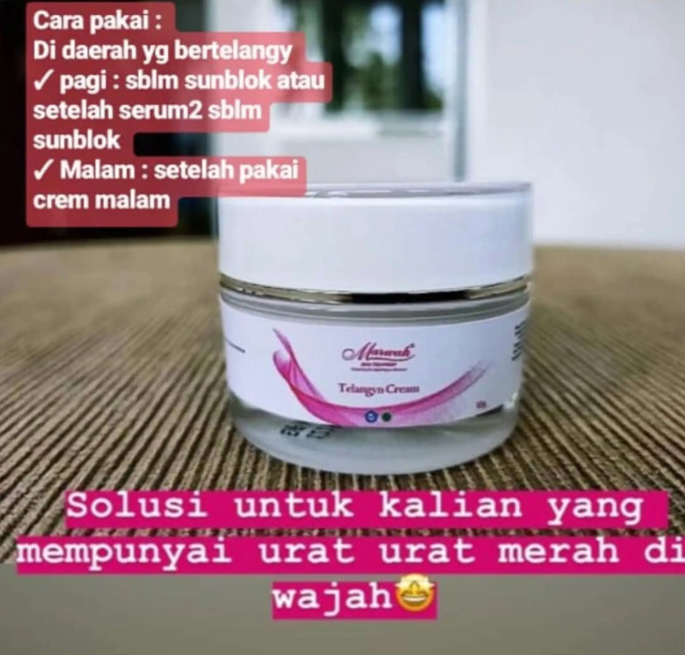 Marwah Telangyn Cream Krim Penghilang Urat Halus Di Wajah Spider Vein Cream Marwah Telangyn Penghilang Urat2 Halus Di Wajah Bpom Lazada Indonesia