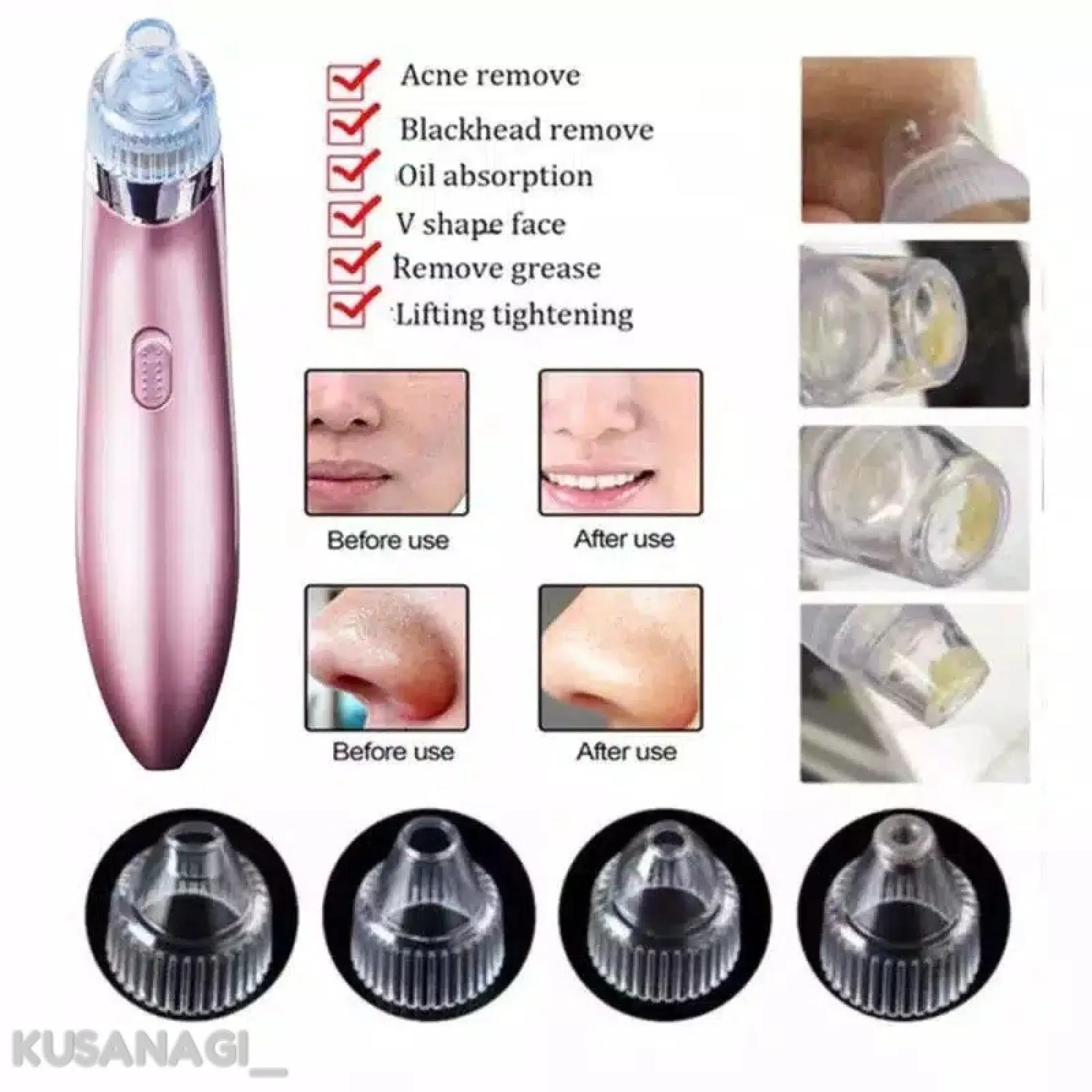 Alat Penyedot Komedo Type Xn 8030 Menghilangkan Komedo Penghilang Komedo Penyedot Komedo Komedo Alat Kecantikan Pembersih Wajah Lazada Indonesia